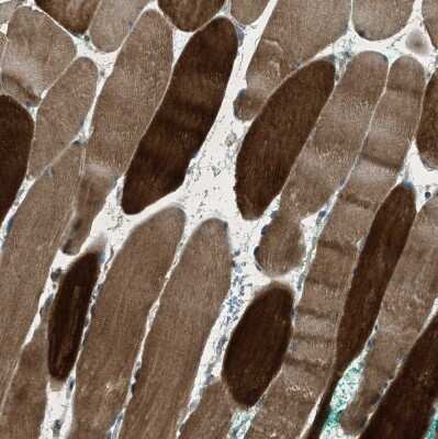 Immunohistochemistry-Paraffin: LKB1/STK11 Antibody [NBP1-87817] - Staining of human skeletal muscle shows moderate to strong cytoplasmic positivity in myocytes.