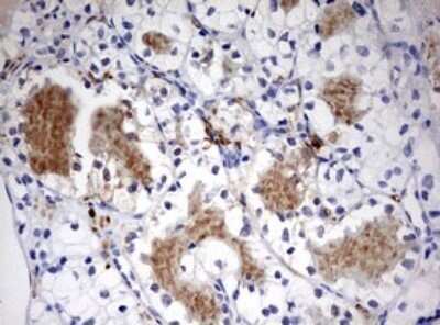 Immunohistochemistry: LKB1/STK11 Antibody (OTI0A3) - Azide and BSA Free [NBP2-71300] - Analysis of Carcinoma of Human kidney tissue. (Heat-induced epitope retrieval by 10mM citric buffer, pH6.0, 120C for 3min)