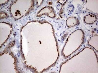 Immunohistochemistry: LKB1/STK11 Antibody (OTI0A3) - Azide and BSA Free [NBP2-71300] - Analysis of Human thyroid tissue. (Heat-induced epitope retrieval by 10mM citric buffer, pH6.0, 120C for 3min)