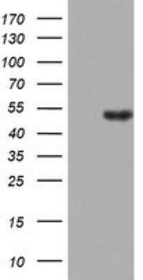 Western Blot: LKB1/STK11 Antibody (OTI0A3) - Azide and BSA Free [NBP2-71300] - Analysis of HEK293T cells were transfected with the pCMV6-ENTRY control (Left lane) or pCMV6-ENTRY STK11.