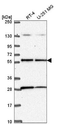 Western Blot: LKB1/STK11 Antibody [NBP2-56895] - Analysis in human cell line RT-4 and human cell line U-251 MG.