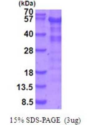 SDS-Page: Recombinant Human LKB1/STK11 Protein [NBP2-51959] -  15% SDS Page (3 ug)