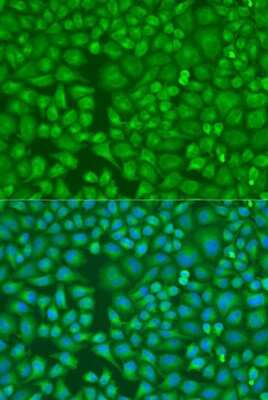 Immunocytochemistry/Immunofluorescence: LLGL2 Antibody [NBP3-05135] - Analysis of U2OS cells using LLGL2 antibody at dilution of 1:100. Blue: DAPI for nuclear staining.