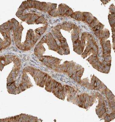 Immunohistochemistry-Paraffin: LLGL2 Antibody [NBP1-81753] - Staining of human fallopian tube shows moderate to strong cytoplasmic postivity in glandular cells.