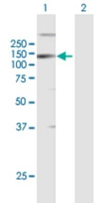 Western Blot: LLGL2 Antibody [H00003993-B01P] - Analysis of LLGL2 expression in transfected 293T cell line by LLGL2 polyclonal antibody.  Lane 1: LLGL2 transfected lysate(112.2 KDa). Lane 2: Non-transfected lysate.