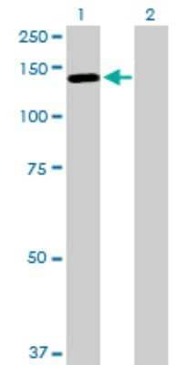 Western Blot: LLGL2 Antibody [H00003993-D01P] - Analysis of LLGL2 expression in transfected 293T cell line by LLGL2 polyclonal antibody.Lane 1: LLGL2 transfected lysate(113.40 KDa).Lane 2: Non-transfected lysate.