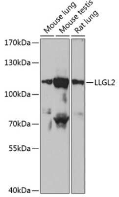 Western Blot: LLGL2 Antibody [NBP3-03969] - Analysis of extracts of various cell lines, using LLGL2 antibody at 1:1000 dilution. Secondary antibody: HRP Goat Anti-Rabbit IgG (H+L) at 1:10000 dilution. Lysates/proteins: 25ug per lane. Blocking buffer: 3% nonfat dry milk in TBST. Detection: ECL Basic Kit.