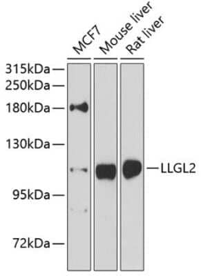 Western Blot: LLGL2 Antibody [NBP3-05135] - Analysis of extracts of various cell lines, using LLGL2 antibody at 1:1000 dilution. Secondary antibody: HRP Goat Anti-Rabbit IgG (H+L) at 1:10000 dilution. Lysates/proteins: 25ug per lane. Blocking buffer: 3% nonfat dry milk in TBST. Detection: ECL Enhanced Kit.