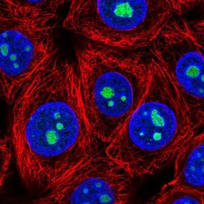 Immunocytochemistry/Immunofluorescence: LLPH Antibody [NBP2-54933] - Staining of human cell line MCF7 shows localization to nucleoli.