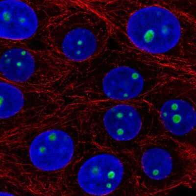 Immunocytochemistry/Immunofluorescence: LLPH Antibody [NBP2-55472] - Staining of human cell line MCF7 shows localization to nucleoli.