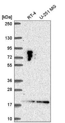 Western Blot: LLPH Antibody [NBP2-55472] - Western blot analysis in human cell line RT-4 and human cell line U-251 MG.
