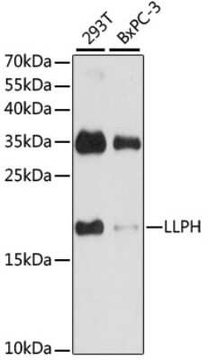 Western Blot: LLPH Antibody [NBP3-04427] - Analysis of extracts of various cell lines, using LLPH antibody at 1:1000 dilution. Secondary antibody: HRP Goat Anti-Rabbit IgG (H+L) at 1:10000 dilution. Lysates/proteins: 25ug per lane. Blocking buffer: 3% nonfat dry milk in TBST. Detection: ECL Basic Kit