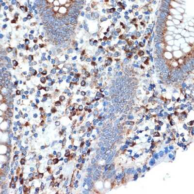 Immunohistochemistry-Paraffin: LMAN1 Antibody (3A1X6) [NBP3-16517] - Immunohistochemistry of paraffin-embedded human appendix using LMAN1 Rabbit mAb (NBP3-16517) at dilution of 1:100 (40x lens).Perform microwave antigen retrieval with 10 mM Tris/EDTA buffer pH 9.0 before commencing with IHC staining protocol.