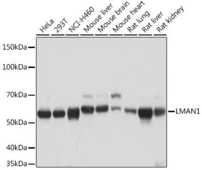 Western Blot: LMAN1 Antibody (3A1X6) [NBP3-16517] - Western blot analysis of extracts of various cell lines, using LMAN1 Rabbit mAb (NBP3-16517) at 1:1000 dilution. Secondary antibody: HRP Goat Anti-Rabbit IgG (H+L) at 1:10000 dilution. Lysates/proteins: 25ug per lane. Blocking buffer: 3% nonfat dry milk in TBST. Detection: ECL Basic Kit. Exposure time: 10s.