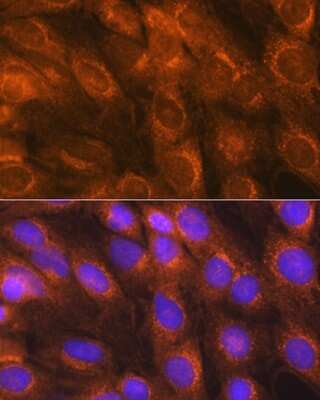 Immunocytochemistry/Immunofluorescence: LMAN1 Antibody [NBP3-04910] - Analysis of C6 cells using LMAN1 Rabbit pAb at dilution of 1:100 (40x lens). Blue: DAPI for nuclear staining. LMAN1 antibody