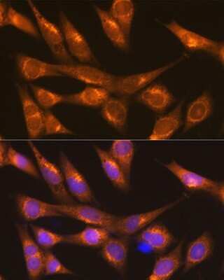 Immunocytochemistry/Immunofluorescence: LMAN1 Antibody [NBP3-04910] - Analysis of NIH-3T3 cells using LMAN1 Rabbit pAb at dilution of 1:100 (40x lens). Blue: DAPI for nuclear staining. LMAN1 antibody