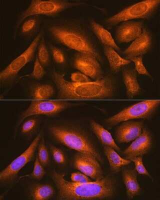 Immunocytochemistry/Immunofluorescence: LMAN1 Antibody [NBP3-04910] - Analysis of U-2 OS cells using LMAN1 Rabbit pAb at dilution of 1:100 (40x lens). Blue: DAPI for nuclear staining. LMAN1 antibody