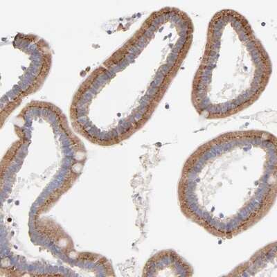 Immunohistochemistry-Paraffin: LMAN1 Antibody [NBP1-84812] - Staining of human duodenum shows strong cytoplasmic positivity with granular pattern in glandular cells.