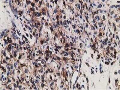 Immunohistochemistry: LMAN1 Antibody (OTI1A8) - Azide and BSA Free [NBP2-71152] - Staining of paraffin-embedded Carcinoma of Human kidney tissue using anti-LMAN1 mouse monoclonal antibody.