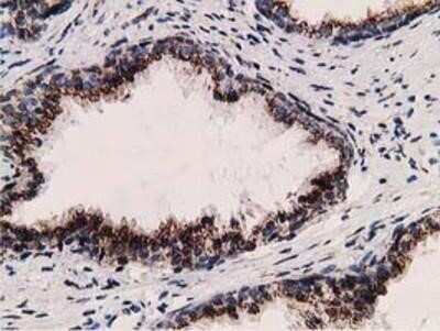 Immunohistochemistry: LMAN1 Antibody (OTI1A8) - Azide and BSA Free [NBP2-71152] - Staining of paraffin-embedded Human prostate tissue using anti-LMAN1 mouse monoclonal antibody.