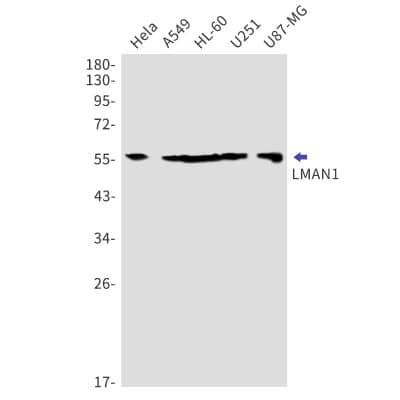 Western Blot: LMAN1 Antibody (S03-5C3) [NBP3-19885] - Western blot detection of LMAN1 in Hela, A549, HL-60, U251, U87-MG cell lysates using NBP3-19885 (1:1000 diluted). Predicted band size: 58kDa. Observed band size: 58kDa.