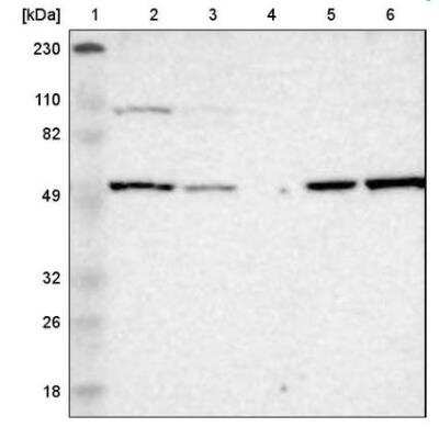 Western Blot: LMAN1 Antibody [NBP1-84812] - Lane 1: Marker [kDa] 230, 110, 82, 49, 32, 26, 18Lane 2: Human cell line RT-4Lane 3: Human cell line U-251MG spLane 4: Human plasma (IgG/HSA depleted)Lane 5: Human liver tissueLane 6: Human tonsil tissue