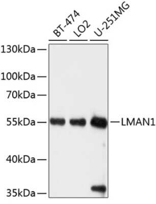 Western Blot: LMAN1 Antibody [NBP3-04910] - Analysis of extracts of various cell lines, using LMAN1 antibody at 1:1000 dilution. Secondary antibody: HRP Goat Anti-Rabbit IgG (H+L) at 1:10000 dilution. Lysates/proteins: 25ug per lane. Blocking buffer: 3% nonfat dry milk in TBST. Detection: ECL Basic Kit