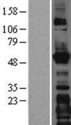 Western Blot: LMAN1 Overexpression Lysate (Adult Normal) [NBL1-12557] Left-Empty vector transfected control cell lysate (HEK293 cell lysate); Right -Over-expression Lysate for LMAN1.