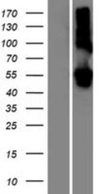 Western Blot: LMAN1L Overexpression Lysate (Adult Normal) [NBP2-06513] Left-Empty vector transfected control cell lysate (HEK293 cell lysate); Right -Over-expression Lysate for LMAN1L.