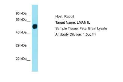 Western Blot: LMAN1L/SLAMP Antibody [NBP2-84138] - Host: Rabbit. Target Name: LMAN1L. Sample Tissue: Human Fetal Brain. Antibody Dilution: 1ug/ml