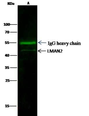 Immunoprecipitation: LMAN2 Antibody (02) [NBP3-05830] - Lane A:0.5 mg Hela Whole Cell Lysate2 uL anti-LMAN2-His mouse monoclonal antibody and 15 ul of 50 % Protein G agarose.Primary antibody:Anti-LMAN2-His mouse monoclonal antibody,at 1:100 dilution Secondary antibody:Dylight 800-labeled antibody to Mouse IgG (H+L), at 1:7500 dilutionDeveloped using the odssey technique.Performed under reducing conditions.Predicted band size: 40 kDaObserved band size: 40 kDa