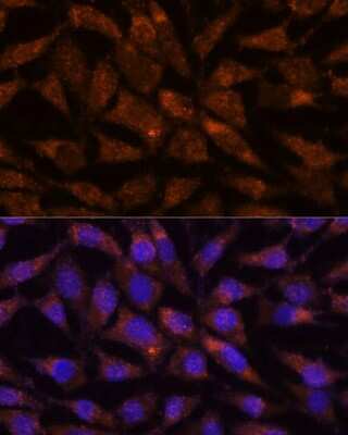 Immunocytochemistry/Immunofluorescence: LMAN2 Antibody [NBP3-04813] - Analysis of L929 cells using LMAN2 antibody at dilution of 1:100. Blue: DAPI for nuclear staining.