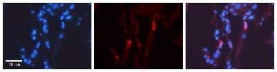 Immunohistochemistry: LMAN2 Antibody [NBP1-69474] - Human Lung Tissue Observed Staining: Cytoplasm of pneumocytes Primary Antibody Concentration: 1 : 100 Other Working Concentrations: 1/600 Secondary Antibody: Donkey anti-Rabbit-Cy3 Secondary Antibody Concentration: 1 : 200 Magnification: 20X.