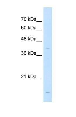 Western Blot: LMAN2 Antibody [NBP1-69474] - This Anti-LMAN2 antibody was used in Western Blot of Jurkat tissue lysate at a concentration of 1ug/ml.