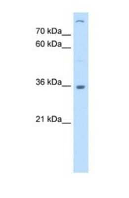 Western Blot: LMAN2 Antibody [NBP1-69475] - This Anti-LMAN2 antibody was used in Western Blot of Jurkat tissue lysate at a concentration of 0.25ug/ml.