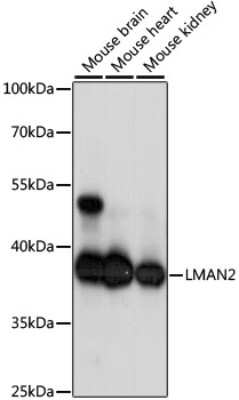 Western Blot: LMAN2 Antibody [NBP3-04813] - Analysis of extracts of various cell lines, using LMAN2 antibody at 1:1000 dilution. Secondary antibody: HRP Goat Anti-Rabbit IgG (H+L) at 1:10000 dilution. Lysates/proteins: 25ug per lane. Blocking buffer: 3% nonfat dry milk in TBST. Detection: ECL Basic Kit