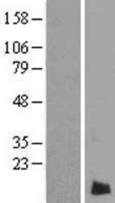 Western Blot: LMAN2L Overexpression Lysate (Adult Normal) [NBP2-06181] Left-Empty vector transfected control cell lysate (HEK293 cell lysate); Right -Over-expression Lysate for LMAN2L.