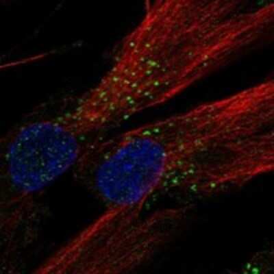 Immunocytochemistry/Immunofluorescence: LMBRD1 Antibody [NBP3-17880] - Staining of human cell line ASC TERT1 shows localization to vesicles.