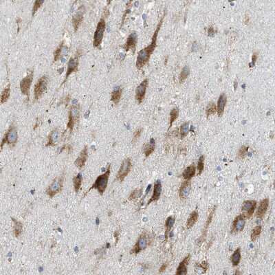 Immunohistochemistry-Paraffin LMBRD1 Antibody - BSA Free