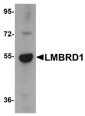 Western Blot: LMBRD1 Antibody [NBP1-76494] - Human brain tissue lysate with LMBRD1 antibody at 1 ug/mL.