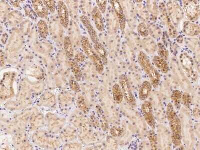 Immunohistochemistry LMBRD2 Antibody - BSA Free
