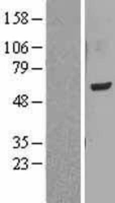 Western Blot: LMF1 Overexpression Lysate (Adult Normal) [NBL1-12562] Left-Empty vector transfected control cell lysate (HEK293 cell lysate); Right -Over-expression Lysate for LMF1.