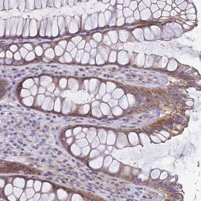Immunohistochemistry-Paraffin: LMF2 Antibody [NBP2-37996] - Staining of human rectum shows moderate cytoplasmic positivity in glandular cells.