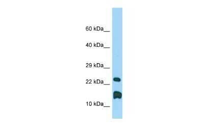 Western Blot: LMO1 Antibody [NBP2-82275] - WB Suggested Anti-Lmo1 Antibody. Titration: 1.0 ug/ml. Positive Control: Rat Testis