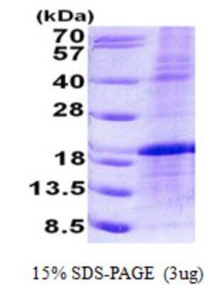 SDS-Page: LMO1 Protein [NBP2-23194]