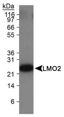 Western Blot: LMO2 Antibody (1A9-3B11) - Azide and BSA Free [NBP2-80835] - Detection of LMO2 in Ramos cell lysate. Image from the standard format of this antibody.