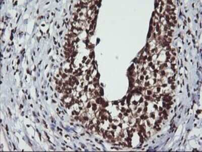 Immunohistochemistry: LMO2 Antibody (OTI1G10) - Azide and BSA Free [NBP2-71157] - Analysis of Human bladder. (Heat-induced epitope retrieval by 10mM citric buffer, pH6.0, 120C for 3min)