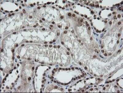 Immunohistochemistry: LMO2 Antibody (OTI1G10) - Azide and BSA Free [NBP2-71157] - Analysis of Human Kidney tissue. (Heat-induced epitope retrieval by 10mM citric buffer, pH6.0, 120C for 3min)