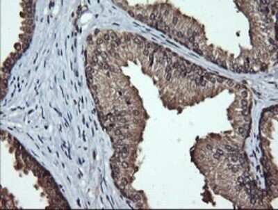 Immunohistochemistry: LMO2 Antibody (OTI1G10) - Azide and BSA Free [NBP2-71157] - Analysis of Human prostate tissue (Heat-induced epitope retrieval by 10mM citric buffer, pH6.0, 120C for 3min)