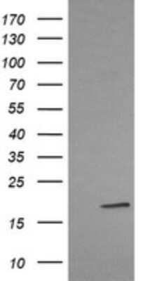 Western Blot: LMO2 Antibody (OTI1G10) - Azide and BSA Free [NBP2-71157] - Analysis of HEK293T cells were transfected with the pCMV6-ENTRY control (Left lane) or pCMV6-ENTRY LMO2.